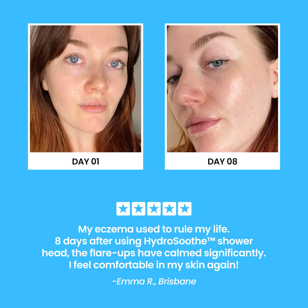 HydroSoothe™ Premium Filtered Shower Head (Includes 5 Filter Refills)